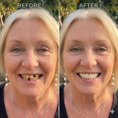 TrueFit Smile